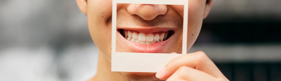 Smile Makeovers in Sacramento CA – FC Smile Makeovers in Sacramento CA – FC